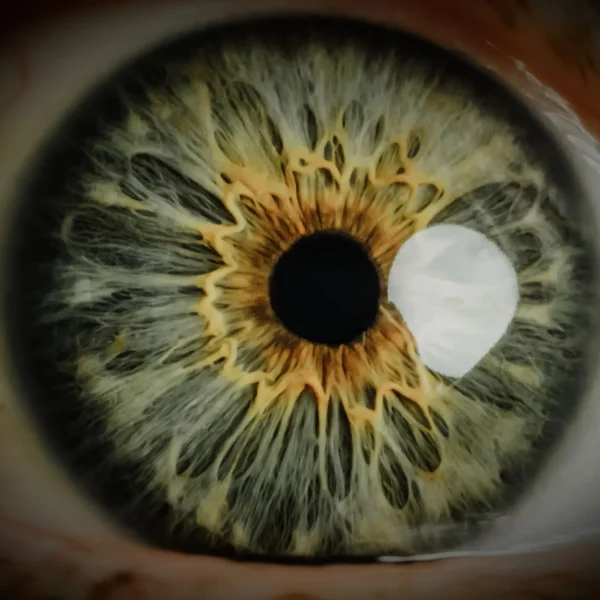 leizuri-bg-terapeuta-naturista-iridologia